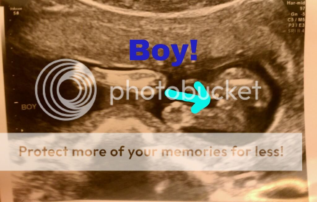 Boy or girl? Let's see those ultrasound "potty shots!" BabyCenter